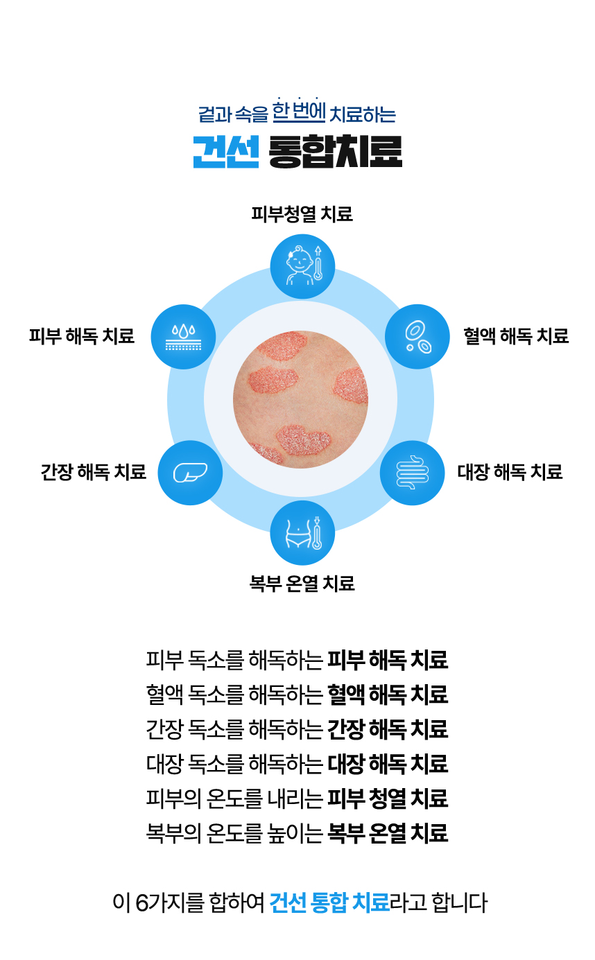 Integrated Psoriasis Treatment