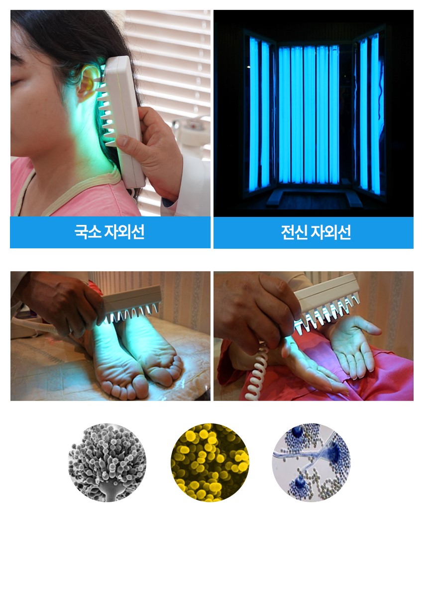 Ultraviolet Treatment