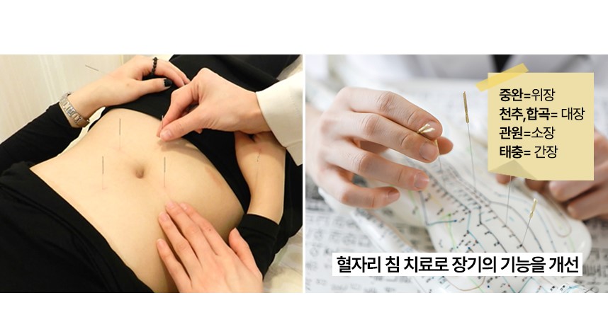 Improving organ function throughacupuncture at specific acupoints.
