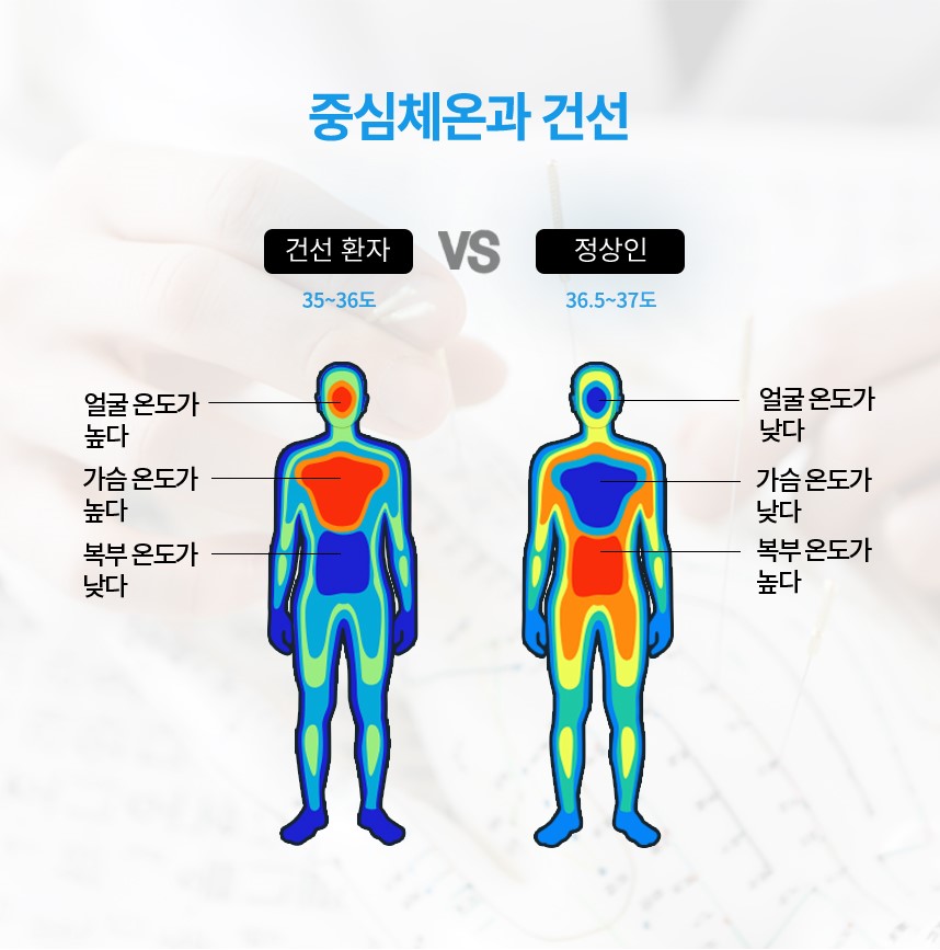 중심체온과 건선