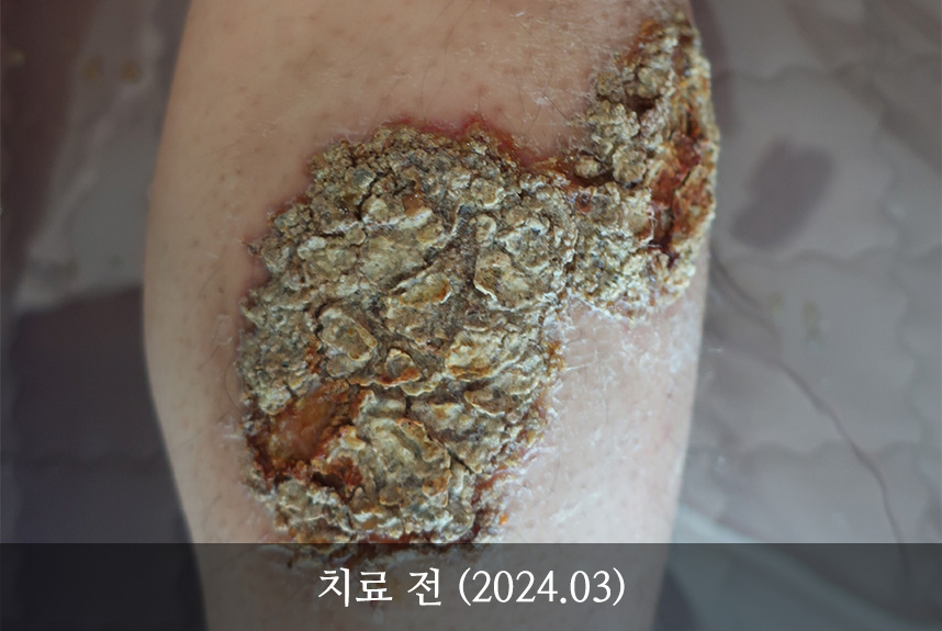 인터뷰 이미지