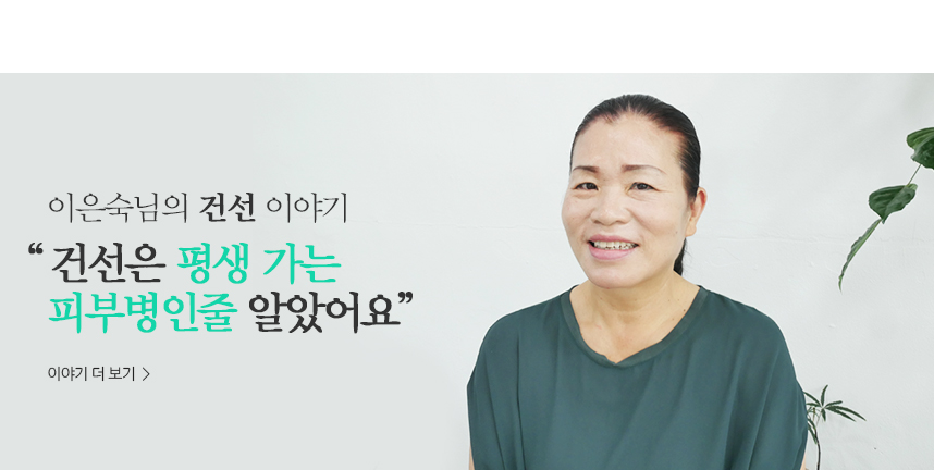 이은숙 건선 이야기