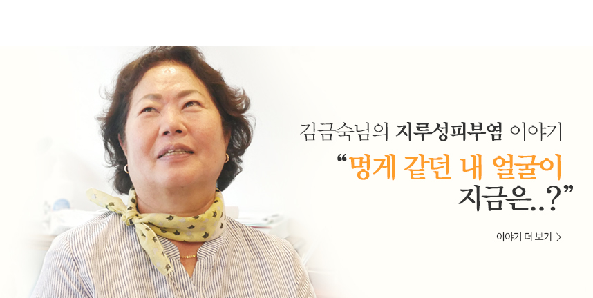 김금숙 지루성피부염 이야기