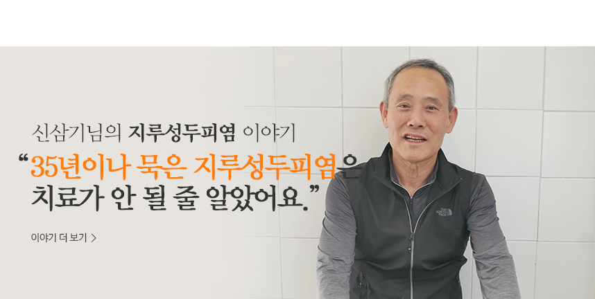 신삼기 지루성두피염 이야기