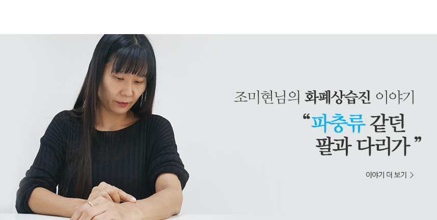 조미현 화폐상습진 이야기