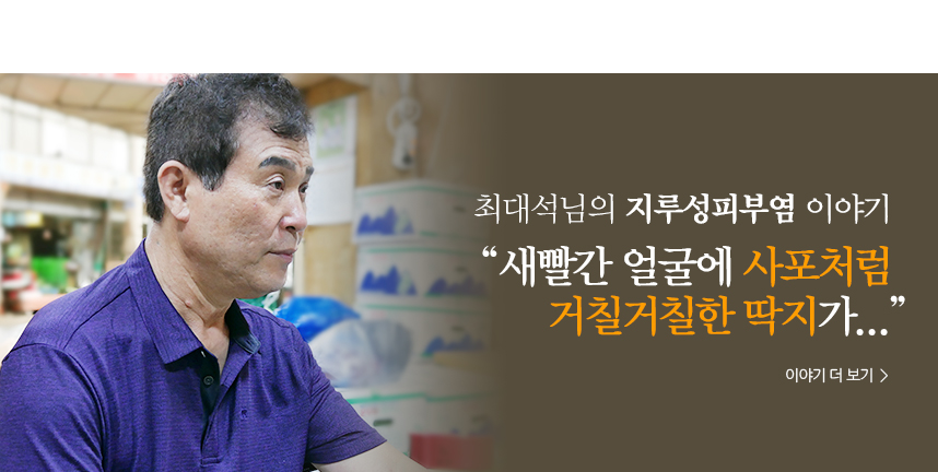 대석 지루성이야기