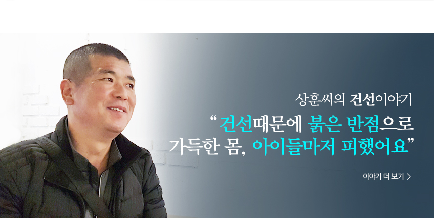 상훈 건선이야기