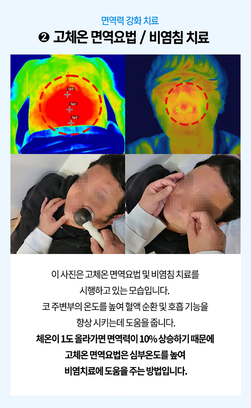 2. 고체온 면역요법 / 비염침 치료 체온이 1도 올라가면 면역력이 10% 상승하기 때문에 고체온 면역요법은 심부온도를 높여 비염치료에 도움을 주는 방법입니다.