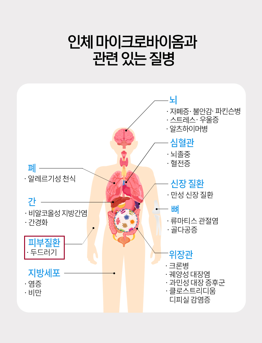 인체 마이크로바이옴과 관련 있는 질병 그래프