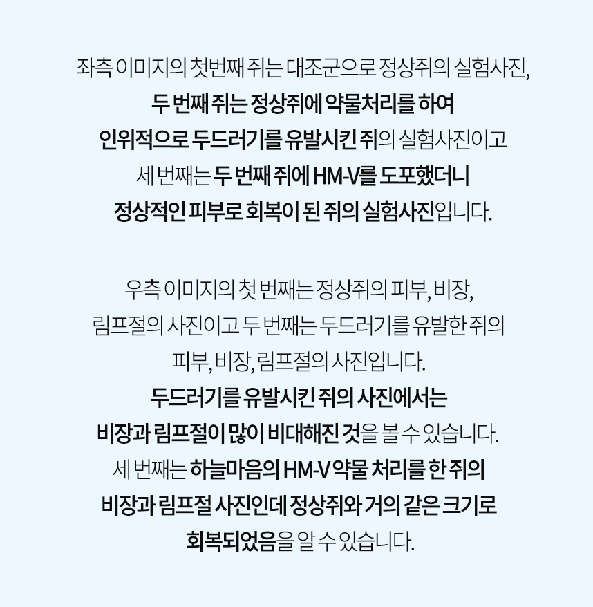 죄측 이미지는 대조군 정상쥐, 인위적으로 두드러기 유발한 쥐, 두드러기 유발 쥐에 HM-V 도포 후 정상 회복 된 쥐 사진 / 우측 이미지는 대조군 정상 쥐의 피부, 비장, 림프절, 인위적으로 두드러기 유발한 쥐의 비대해진 비장, 림프절, 두드러기 유발 쥐에 HM-V 도포 후 정상쥐와 거의 같은 크기로 회복된 비장, 림프절 사진