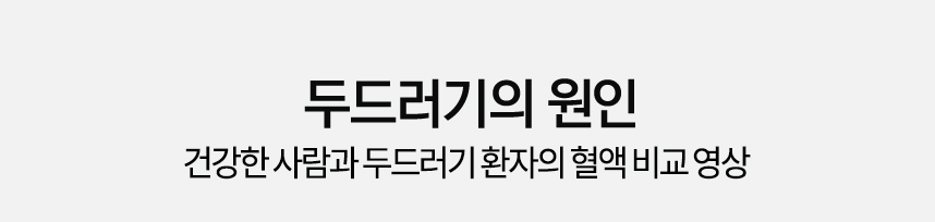 두드러기의 원인 건강한 사람과 두드러기 환자의 혈액 비교 영상