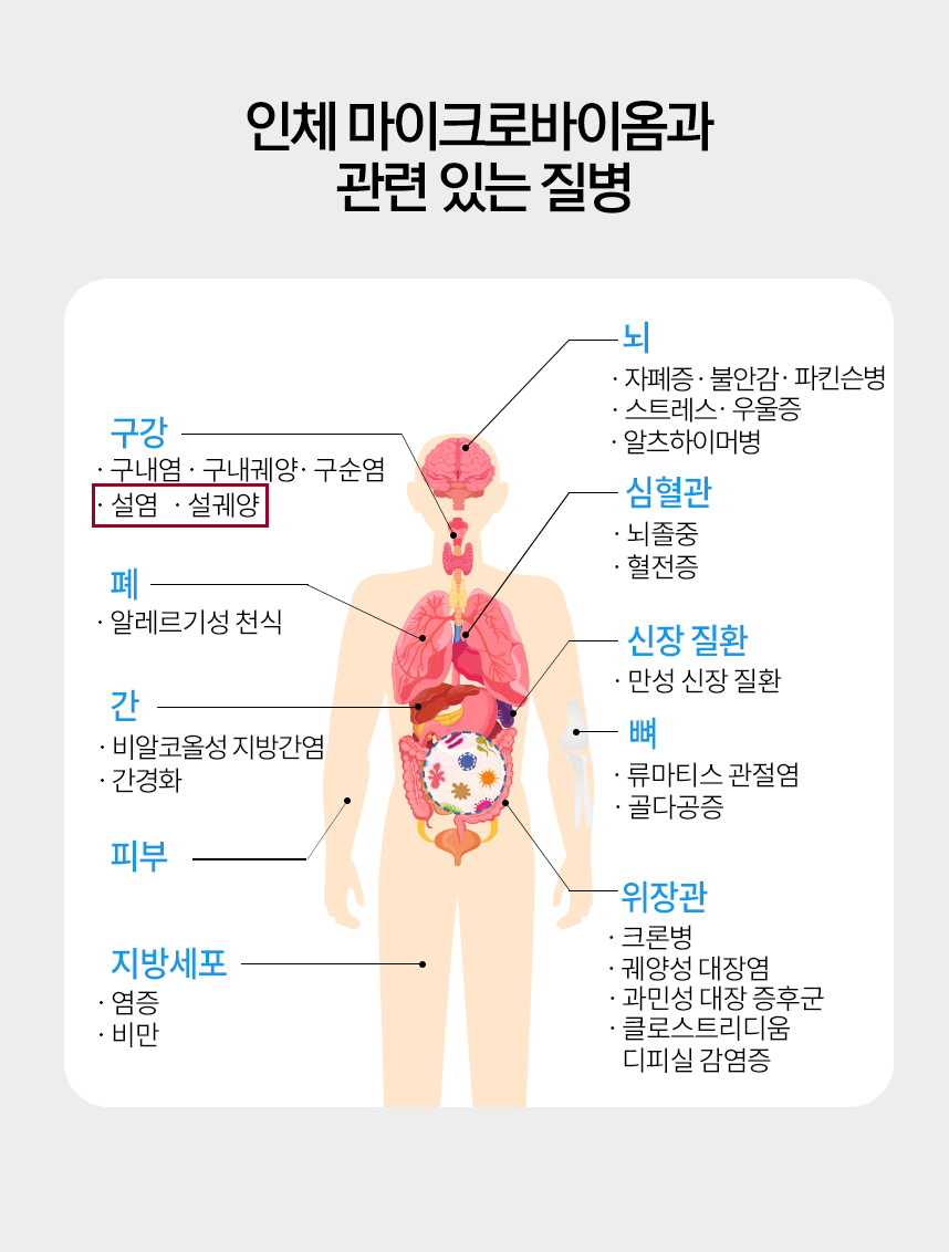 인체 마이크로바이옴과 관련 있는 질병 그래프