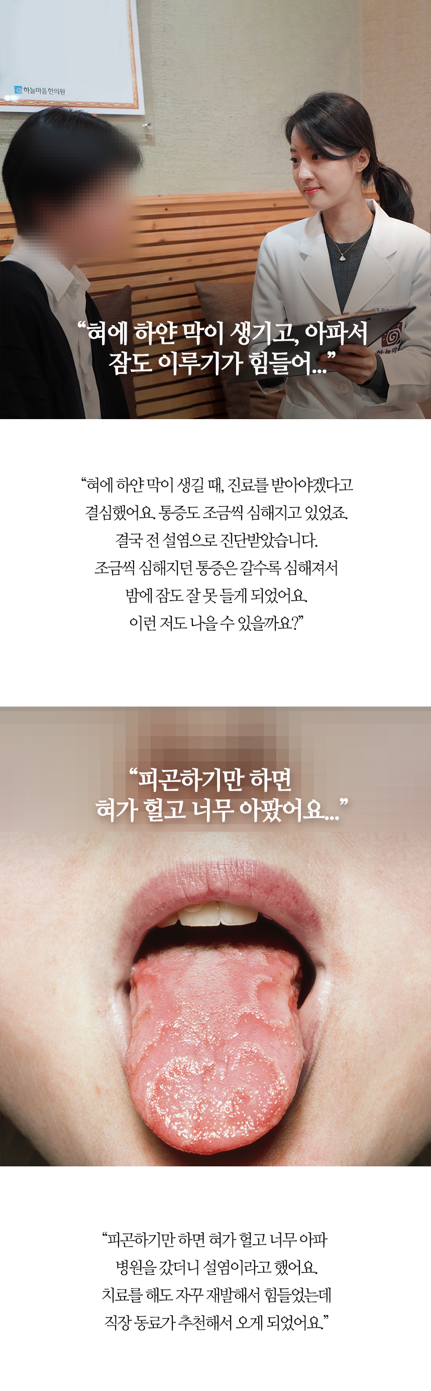 혀가 자꾸 헐어서 음식 먹기가 너무 힘들었어요.