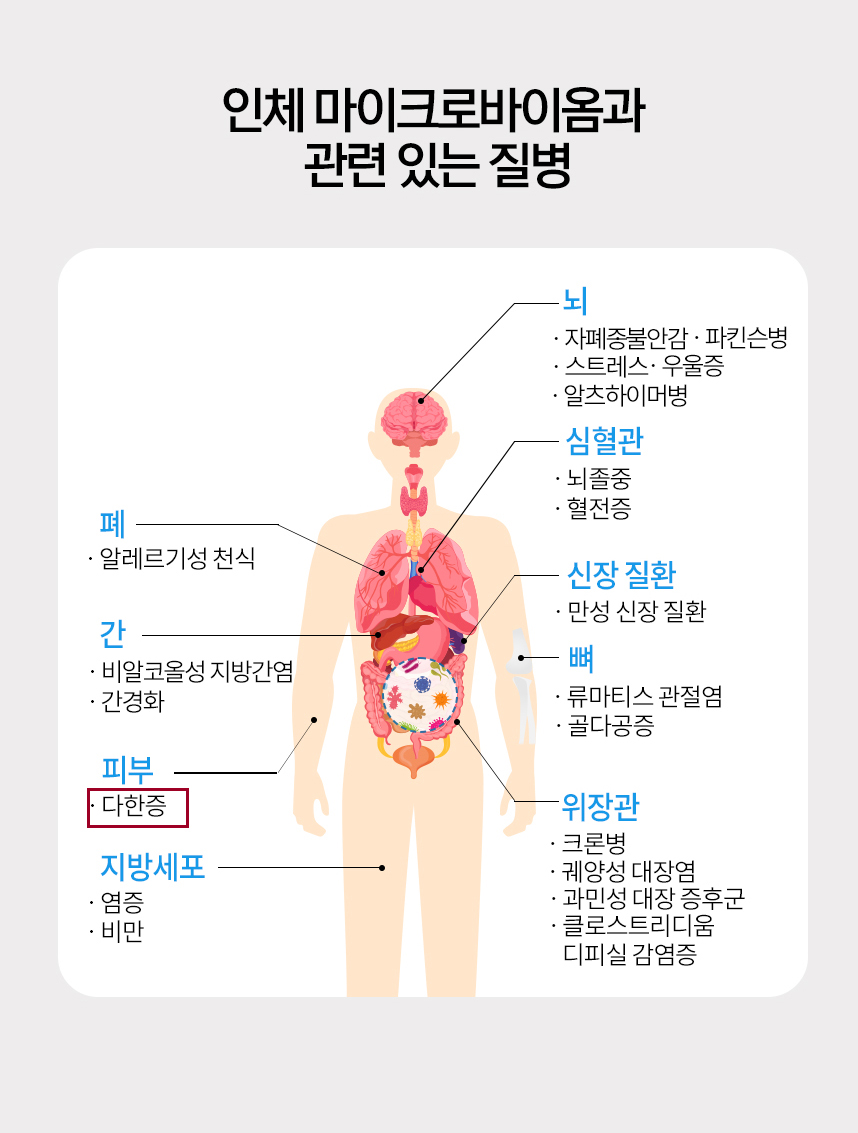 인체 마이크로바이옴과 관련 있는 질병 그래프