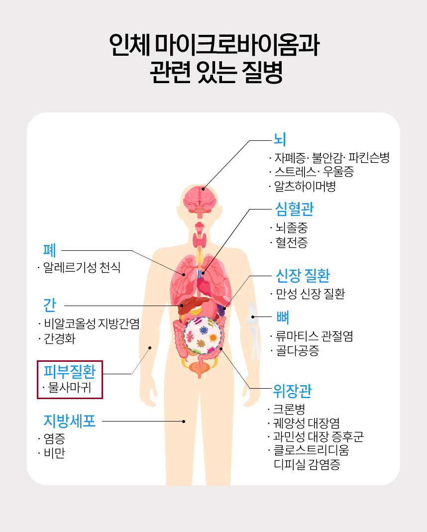 인체 마이크로바이옴과 관련 있는 질병 그래프