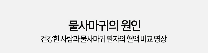 물사마귀의 원인 건강한 사람과 물사마귀 환자의 혈액 비교 영상