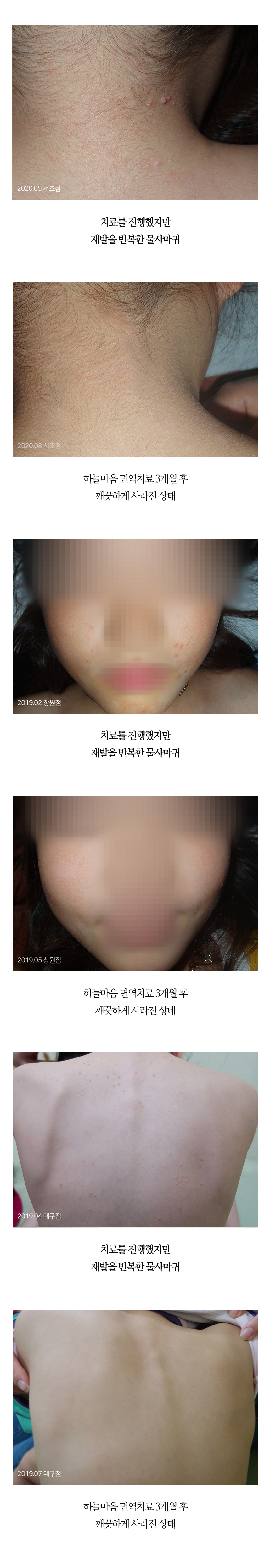 치료전후 이미지3