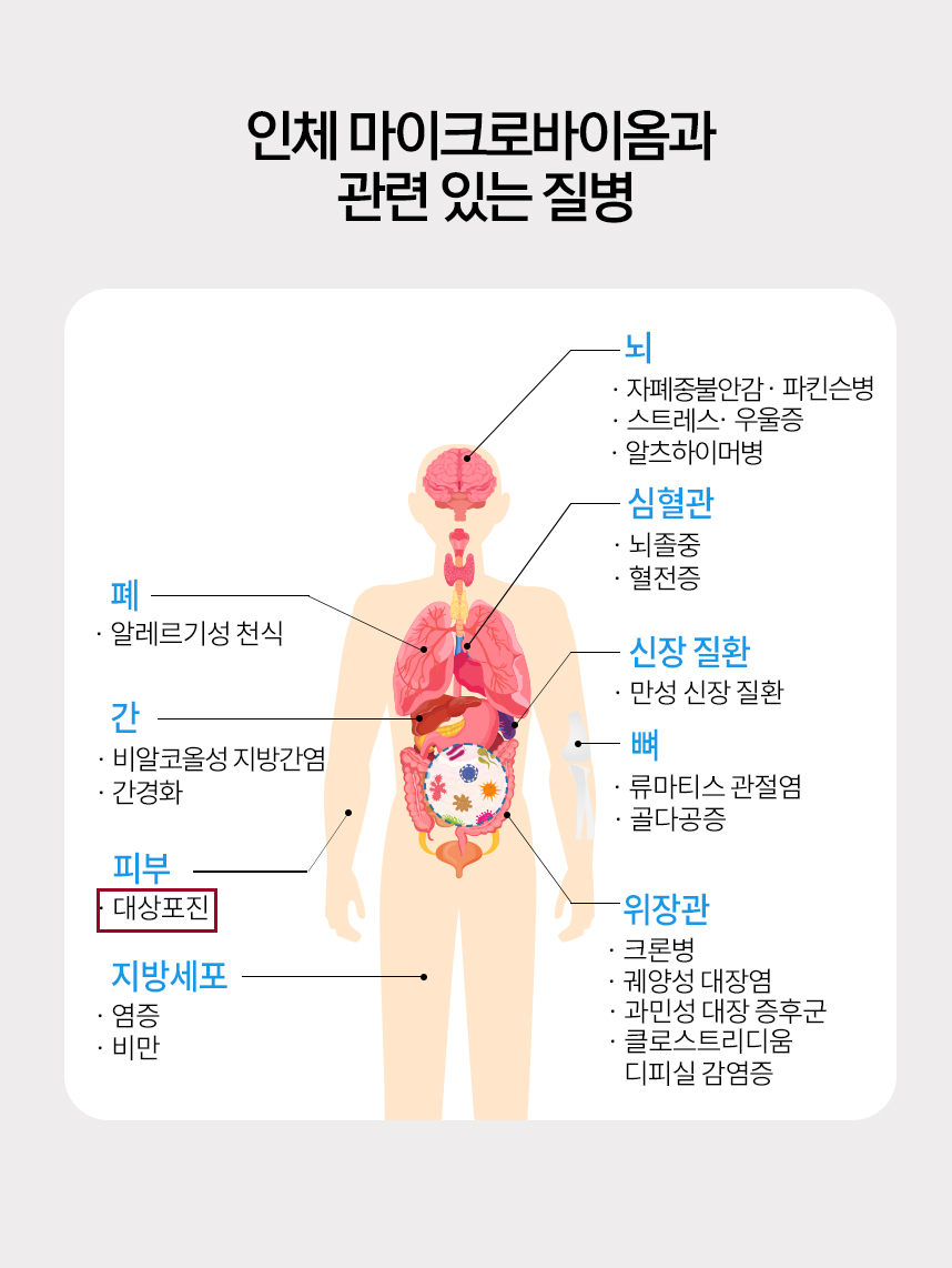인체 마이크로바이옴과 관련 있는 질병 그래프