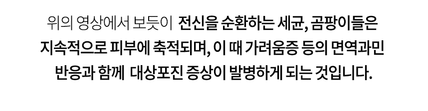 전신을 순환하는 세균, 곰팡이들을 지속적으로 피부에 축적되며, 이 때 가려움증 등의 면역과민 반응과 함께 대상포진 증상이 발병하게 되는 것입니다.