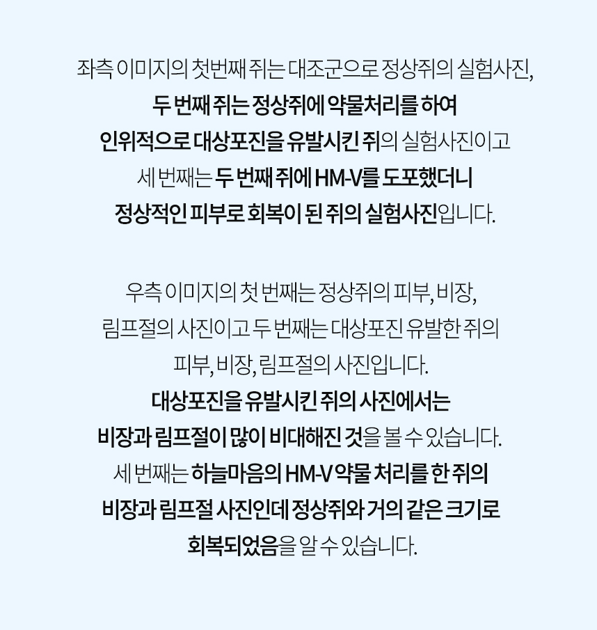 죄측 이미지는 대조군 정상쥐, 인위적으로 대상포진 유발한 쥐, 대상포진 유발 쥐에 HM-V 도포 후 정상 회복 된 쥐 사진 / 우측 이미지는 대조군 정상 쥐의 피부, 비장, 림프절, 인위적으로 대상포진 유발한 쥐의 비대해진 비장, 림프절, 대상포진 유발 쥐에 HM-V 도포 후 정상쥐와 거의 같은 크기로 회복된 비장, 림프절 사진