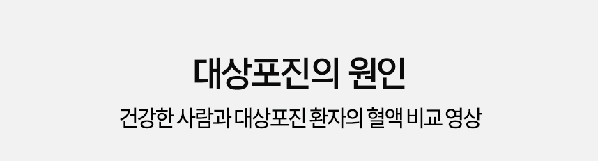대상포진의 원인 건강한 사람과 대상포진 환자의 혈액 비교 영상