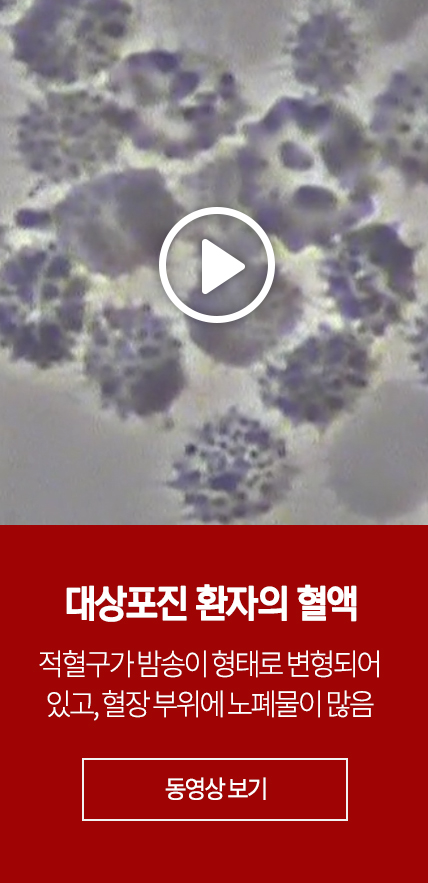대상포진 환자의 혈액 : 적혈구가 밤송이 형태로 변형되어 있고, 혈장 부위에 노폐물이 많음 - 동영상 보기
