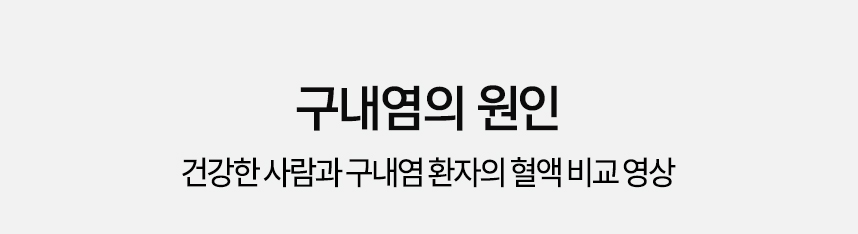 구내염, 구내궤양의 원인 건강한 사람과 구내염, 구내궤양 환자의 혈액 비교 영상