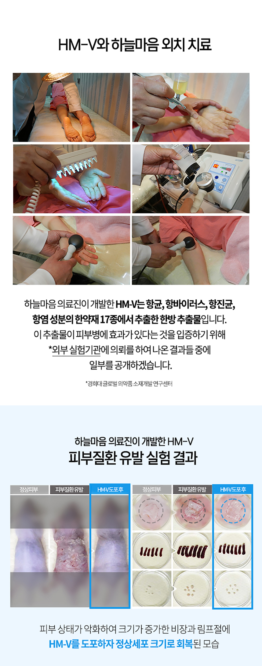 HM-V와 하늘마음 외치 치료 HM-V는 항균, 항바이러스, 항진균, 항염 성분의 한약재 17종에서 추출한 한방 추출물 피부병 효과가 있다는 것을 입증하기 위해 외부 실험기관 의뢰 결과 일부 공개 피부 질환 유발 실험 결과. 피부 상태가 악화하여 크기가 증가한 비장과 림프절에 HM-V를 도포하자 정상세포 크기로 회복된 모습