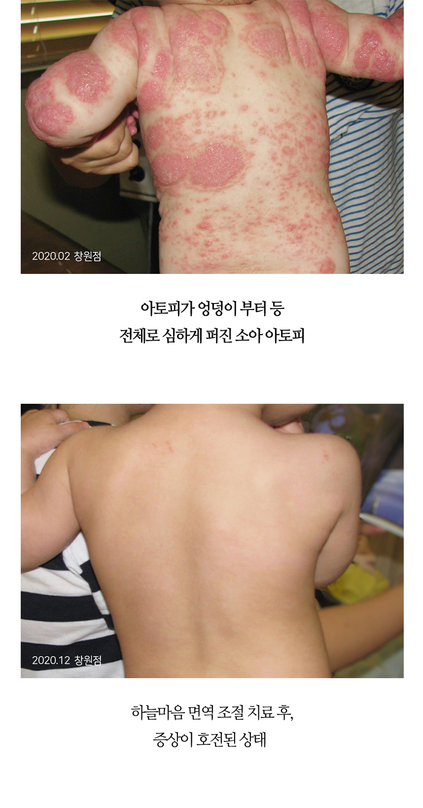 치료전후 이미지7