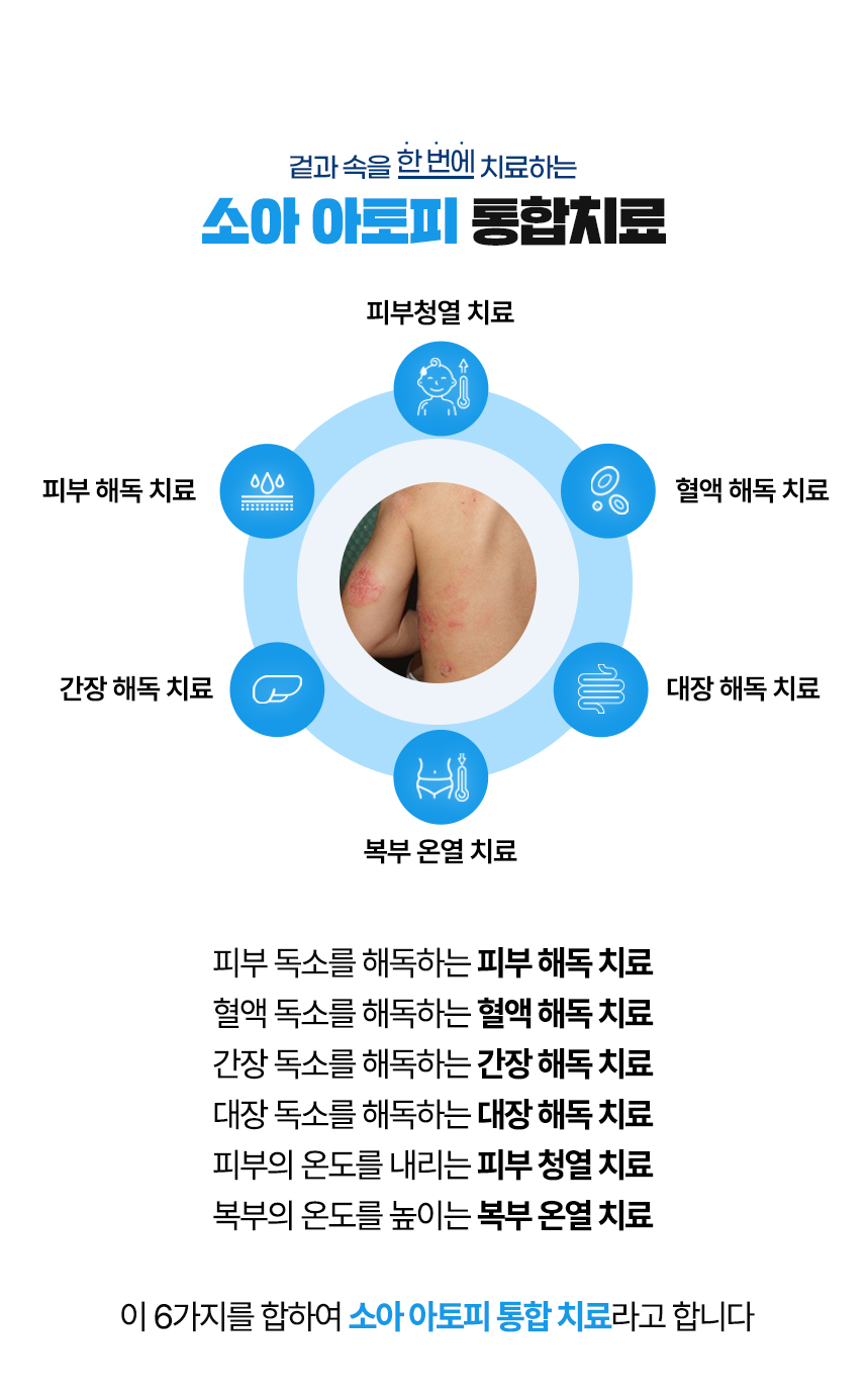 겉과 속을 함번에 치료하는 아토피 통합치료 / 사중독소 장독소, 간독소, 혈액독소, 피부독소 사중독소의 4중 해독 치료 피부, 피부의 열을 내리는 피부 청열 치료, 복부의 온도를 높이는 복부 온열 치료