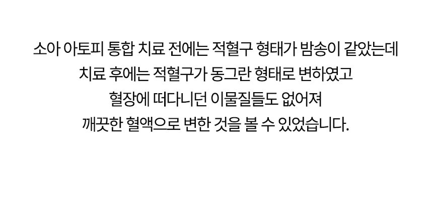 치료 전에는 적혈구 형태가 밤송이 같았는데 치료 후에는 동그란 형태로 변했고 혈장에 떠다니던 이물질들도 없어져 깨끗한 혈액으로 변한 것을 볼 수 있었습니다.
