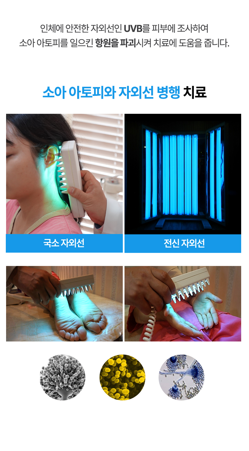 인체에 안전한 UVB를 피부에 조사하여 아토피를 일으킨 항원을 파괴하여 치료에 도움을 줍니다.