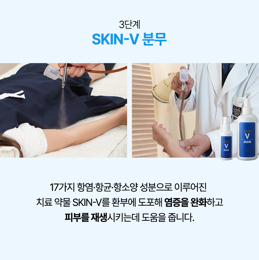 3단계 skin-v 분무