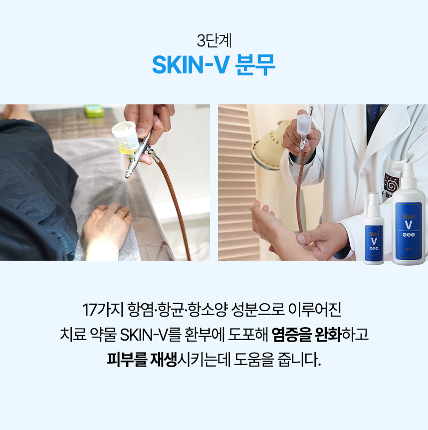 3단계 skin-v 분무