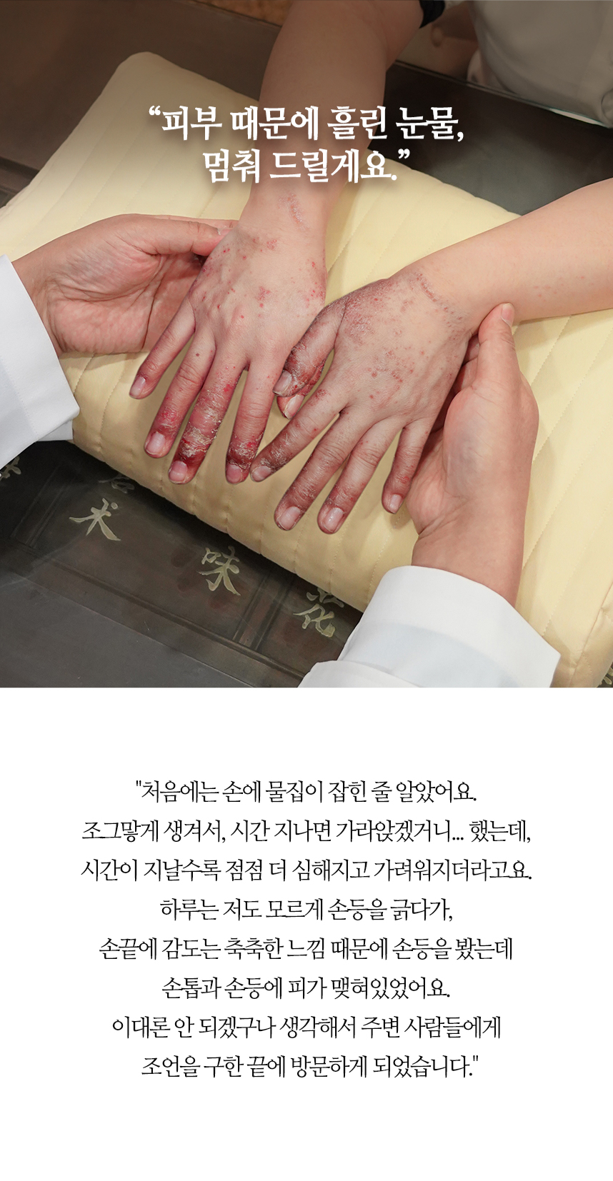피부 때문에 흘린 눈물 멈춰드릴게요.