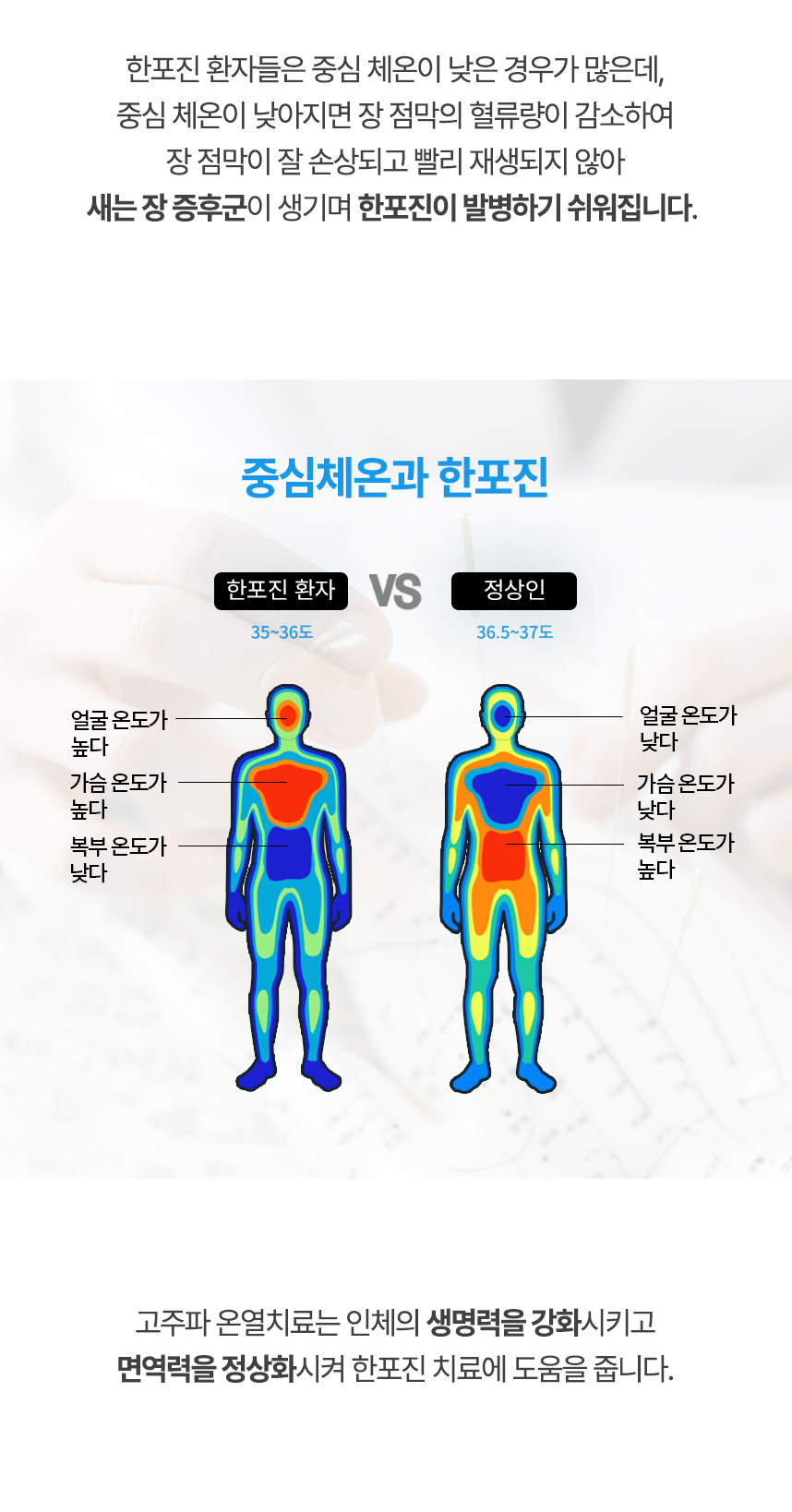 중심 체온이 낮아지면 장 점막의 혈류량이 감소하여 장 점막이 잘 손상되고 빨리 재생되지 않아 새는 장 증후군이 생기며 한포진이 발병하기 쉬워집니다. 고주파 온열치료는 인체의 생명력을 강화시키고 면역력을 정상화시켜 한포진 치료에 도움을 줍니다.