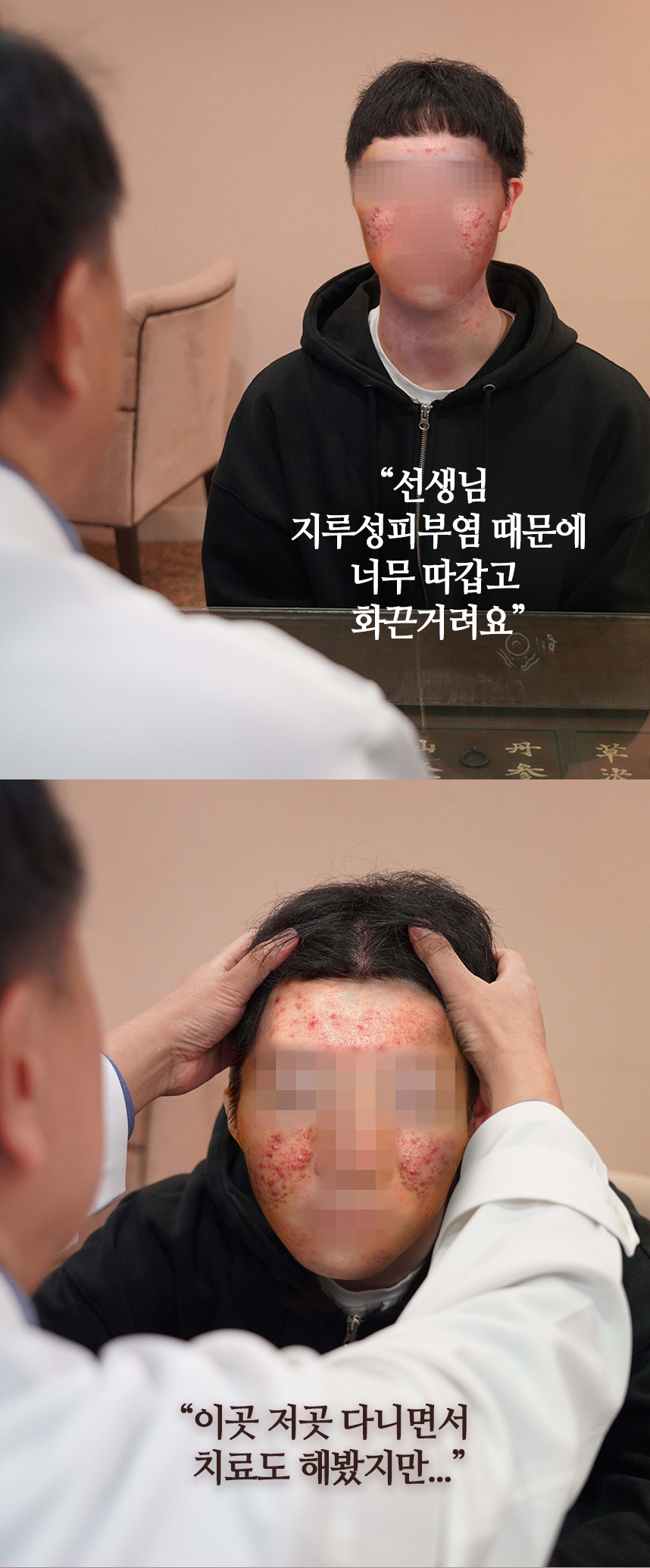 선생님 지루성피부염 때문에 너무 따갑고 화끈거려요. 이곳저곳 다니면서 치료도 해봤지만