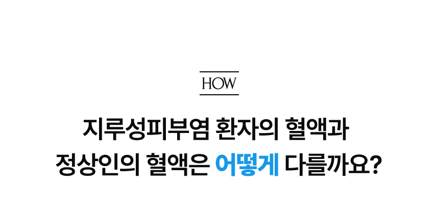 지루성피부염 환자의 혈액과 정상인의 혈액은 어떻게 다를까요?.