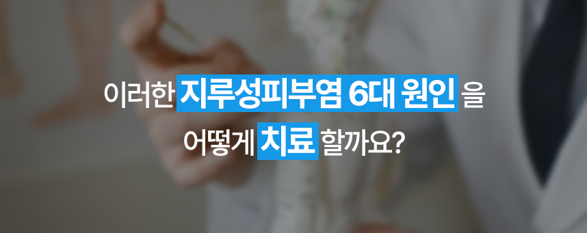 이러한 지루성피부염 6대 원인을 어떻게 치료할까요?