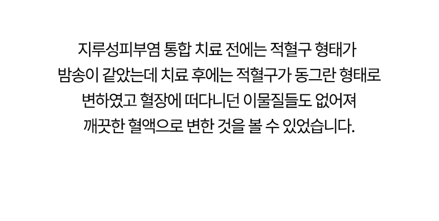 치료 전에는 적혈구 형태가 밤송이 같았는데 치료 후에는 동그란 형태로 변했고 혈장에 떠다니던 이물질들도 없어져 깨끗한 혈액으로 변한 것을 볼 수 있었습니다.