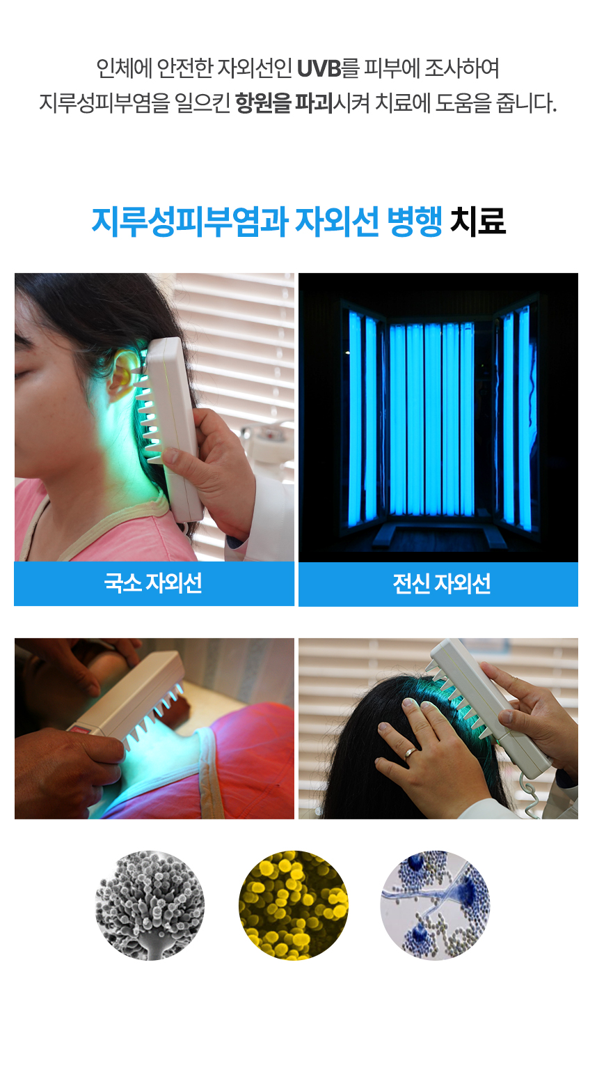 인체에 안전한 내로밴드 UVB를 피부에 	조사하여 지루성피부염을 일으킨 항원을 파괴하여 치료에 도움을 줍니다.