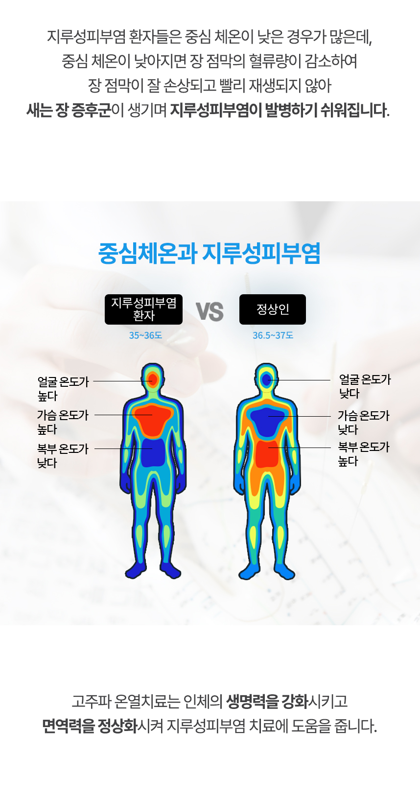 중심 체온이 낮아지면 장 점막의 혈류량이 감소하여 장 점막이 잘 손상되고 빨리 재생되지 않아 새는 장 증후군이 생기며 지루성피부염이 발병하기 쉬워집니다. 고주파 온열치료는 인체의 생명력을 강화시키고 면역력을 정상화시켜 지루성피부염 치료에 도움을 줍니다.
