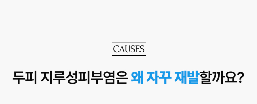 두피 지루성피부염은 왜 자꾸 재발할까요?