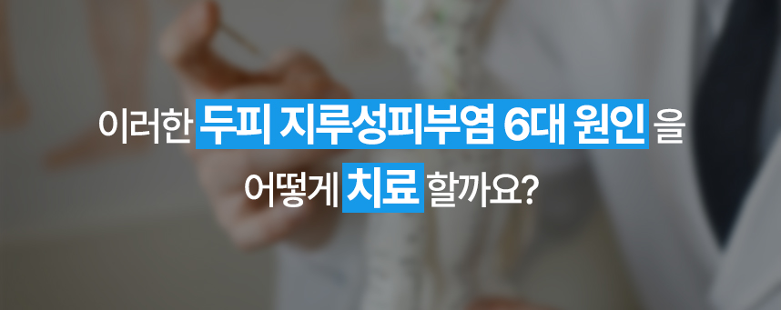 이러한 두피 지루성피부염 6대 원인을 어떻게 치료할까요?