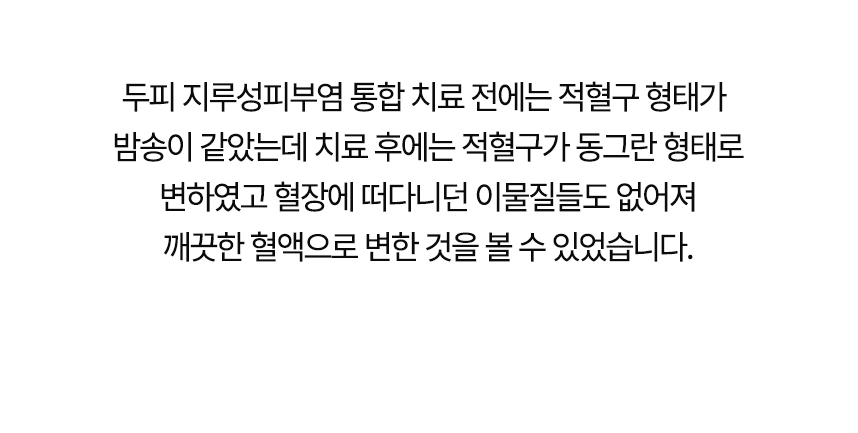 치료 전에는 적혈구 형태가 밤송이 같았는데 치료 후에는 동그란 형태로 변했고 혈장에 떠다니던 이물질들도 없어져 깨끗한 혈액으로 변한 것을 볼 수 있었습니다.