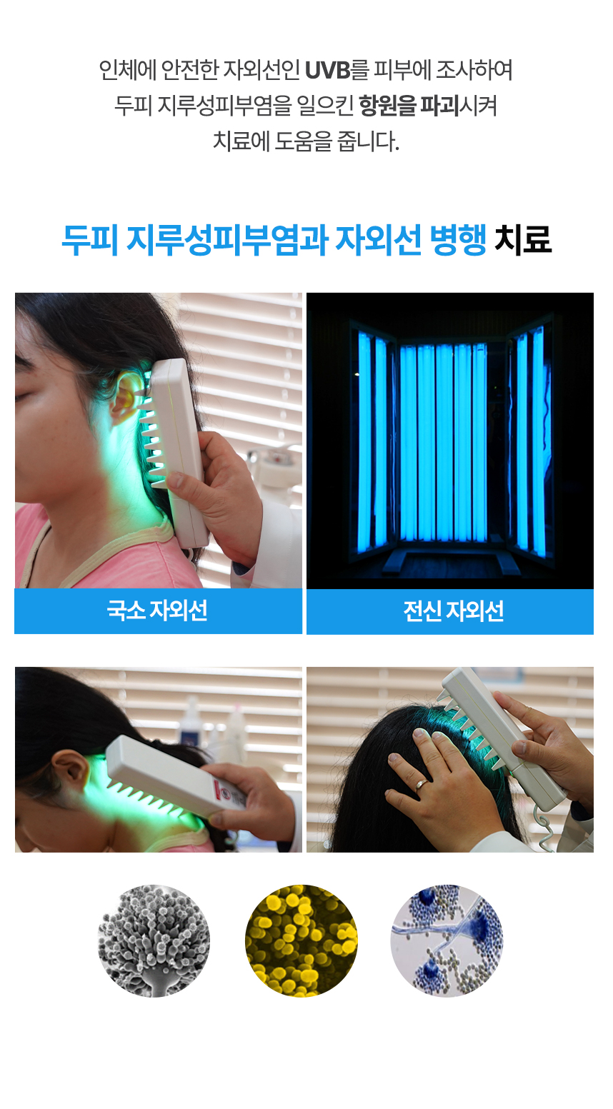 인체에 안전한 내로밴드 UVB를 피부에 	조사하여 두피 지루성피부염을 일으킨 항원을 파괴하여 치료에 도움을 줍니다.