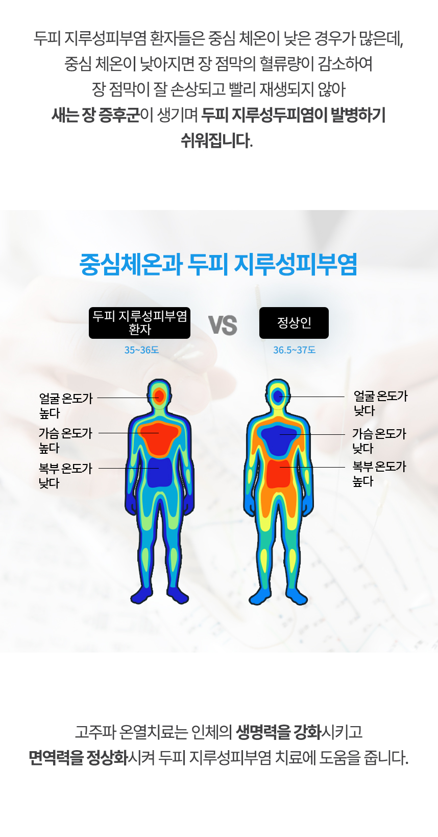 중심 체온이 낮아지면 장 점막의 혈류량이 감소하여 장 점막이 잘 손상되고 빨리 재생되지 않아 새는 장 증후군이 생기며 두피 지루성피부염이 발병하기 쉬워집니다. 고주파 온열치료는 인체의 생명력을 강화시키고 면역력을 정상화시켜 두피 지루성피부염 치료에 도움을 줍니다.