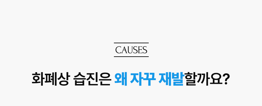 화퍠싱 습진 왜 자꾸 재발할까요?