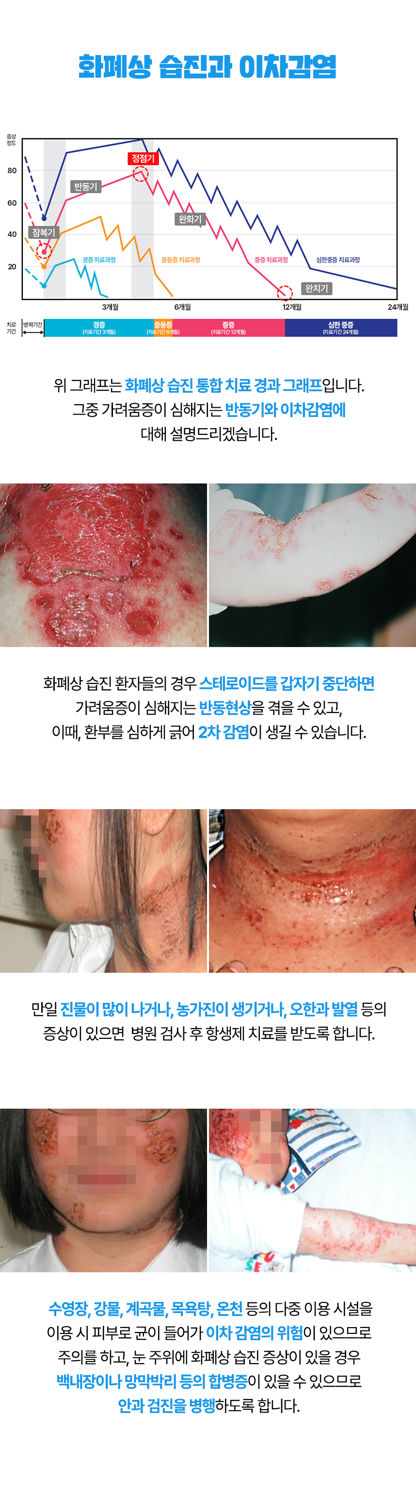 스테로이드를 갑자기 중단하면 반동현상을 겪을 수 있고 이차감염이 생길 수 있습니다.
