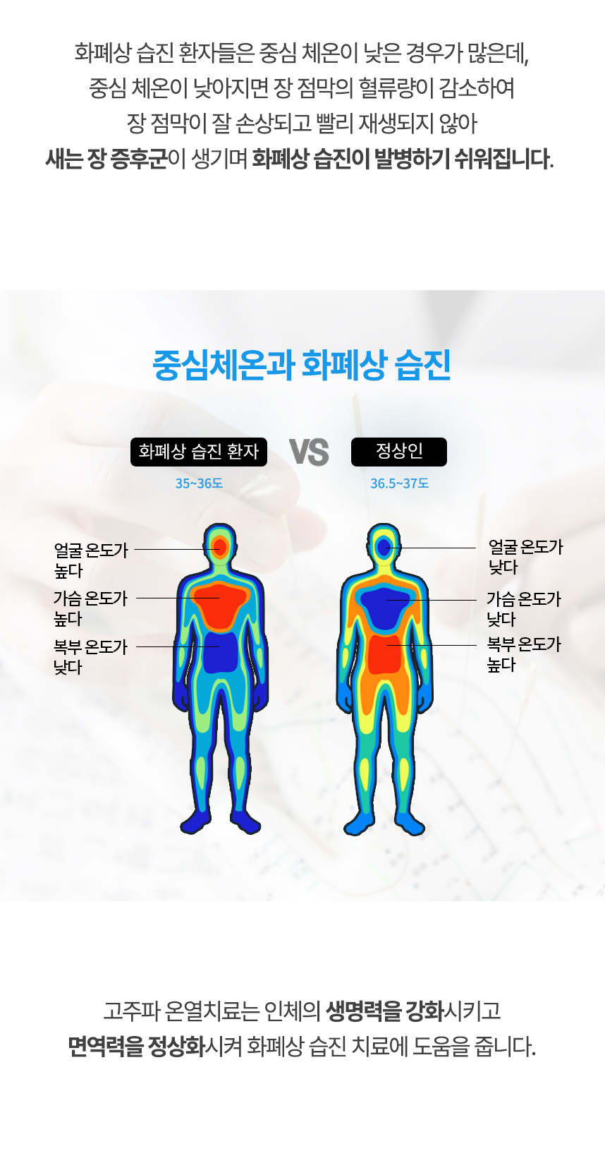 중심 체온이 낮아지면 장 점막의 혈류량이 감소하여 장 점막이 잘 손상되고 빨리 재생되지 않아 새는 장 증후군이 생기며 화폐살 습진이 발병하기 쉬워집니다. 고주파 온열치료는 인체의 생명력을 강화시키고 면역력을 정상화시켜 화폐상 습진 치료에 도움을 줍니다.